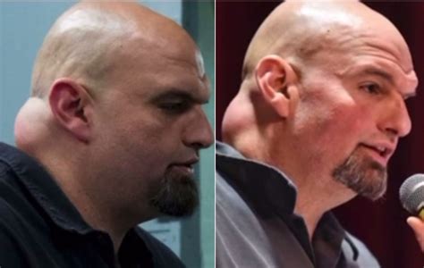 John Fetterman the former mayor of a western Pennsylvania Rust Belt town called Braddock who later became lieutenant governor and is now . . Fetterman neck lump
